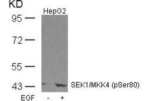 Western blot analysis of extracts from HepG2 cells untreated or treated with EGF using SEK1/MKK4(Phospho-Ser80) Antibody. (MAP2K4 Antikörper  (pSer80))
