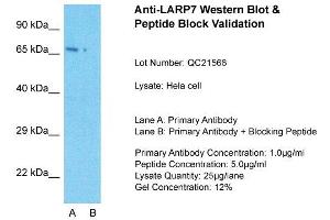 Host: Rabbit  Target Name: LARP7  Sample Tissue: Hela Whole cell  Lane A:  Primary Antibody Lane B:  Primary Antibody + Blocking Peptide Primary Antibody Concentration: 1 µg/mL Peptide Concentration: 5 µg/mL Lysate Quantity: 41 µg/laneGel Concentration:. (LARP7 Antikörper  (C-Term))