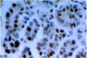 Immunohistochemistry (IHC) image for anti-RAD17 (RAD17) antibody (ABIN492574) (RAD17 Antikörper)