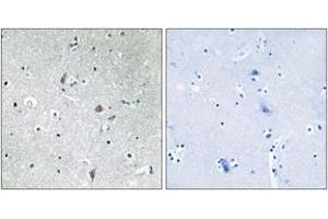 Immunohistochemistry (IHC) image for anti-Mechanistic Target of Rapamycin (serine/threonine Kinase) (mTOR) (AA 2415-2464), (pSer2448) antibody (ABIN1531910)