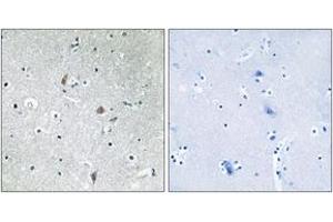 Immunohistochemistry analysis of paraffin-embedded human brain, using mTOR (Phospho-Ser2448) Antibody. (MTOR Antikörper  (pSer2448))