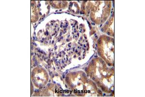 TLL2 Antibody (N-term) (ABIN392519 and ABIN2842079) immunohistochemistry analysis in formalin fixed and paraffin embedded human kidney tissue followed by peroxidase conjugation of the secondary antibody and DAB staining. (Tolloid-Like 2 Antikörper  (N-Term))