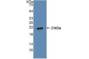 Detection of Recombinant PRDM1, Human using Polyclonal Antibody to PR Domain Containing Protein 1 (PRDM1) (PRDM1 Antikörper  (AA 29-149))