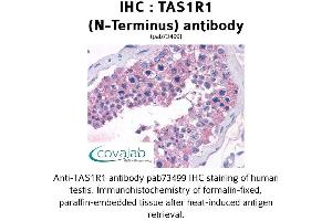 Image no. 1 for anti-Taste Receptor, Type 1, Member 1 (TAS1R1) (Extracellular Domain), (N-Term) antibody (ABIN1739915) (TAS1R1 Antikörper  (Extracellular Domain, N-Term))