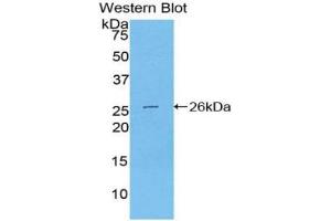 Western blot analysis of the recombinant protein. (Transportin 1 Antikörper  (AA 597-837))