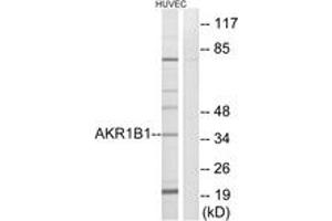 Western blot analysis of extracts from HuvEc cells, using AKR1B1 Antibody. (AKR1B1 Antikörper  (AA 241-290))