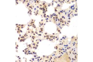 Immunohistochemistry of paraffin-embedded mouse lung using CSNK2 antibody (ABIN6127663, ABIN6139128, ABIN6139129 and ABIN6217497) at dilution of 1:100 (40x lens).