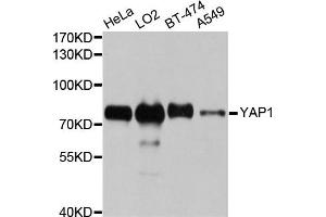 Western blot analysis of extracts of various cell lines, using YAP1 antibody (ABIN5970389) at 1/1000 dilution. (YAP1 Antikörper)