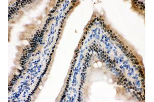Immunohistochemistry (IHC) image for anti-Histidine Triad Nucleotide Binding Protein 1 (HINT1) (AA 59-92), (Middle Region) antibody (ABIN3042445)