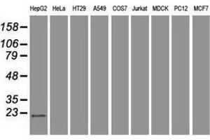Western blot analysis of extracts (35 µg) from 9 different cell lines by using anti-AK1 monoclonal antibody. (Adenylate Kinase 1 Antikörper)