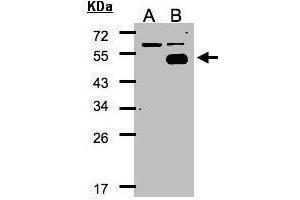 WB Image Western Blot analysis of NR2F1 expression in transfected 293T cell line by NR2F1 polyclonal antibody.