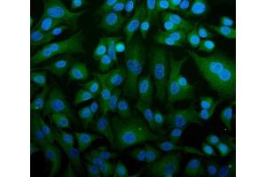 anti-Stromal Interaction Molecule 1 (STIM1) (AA 45-74), (N-Term) antibody