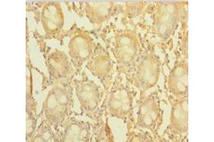 Immunohistochemistry of paraffin-embedded human colon tissue using ABIN7148176 at dilution of 1:100 (CCDC94 Antikörper  (AA 1-279))