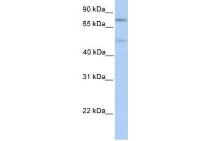 WB Suggested Anti-SP1 Antibody Titration:  0. (SP1 Antikörper  (Middle Region))