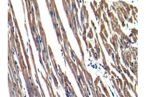 DAB staining on IHC-P; Samples: Rat Heart Tissue (MYH6 Antikörper  (AA 1747-1938))