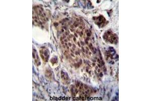 Immunohistochemistry (IHC) image for anti-Frequently Rearranged in Advanced T-Cell Lymphomas 2 (FRAT2) antibody (ABIN2996405)