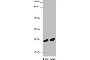 Western blot All lanes: PSPH antibody at 3. (PSPH Antikörper  (AA 1-225))