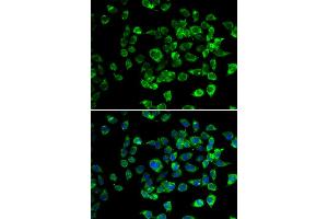 Immunofluorescence analysis of U2OS cells using PSMD13 antibody. (PSMD13 Antikörper)