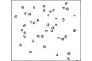 Immunocytochemistry of NOD2 in Jurkat cells with this product at 5 μg/ml. (NOD2 Antikörper  (N-Term))