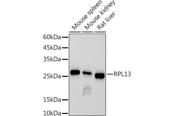 RPL13 anticorps