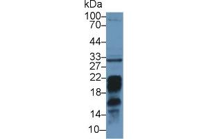 Detection of PDL2 in Mouse Liver lysate using Polyclonal Antibody to Programmed Cell Death Protein 1 Ligand 2 (PDL2) (PDCD1LG2 Antikörper  (AA 36-219))