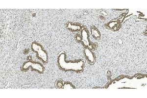 IHC analysis of ERK5/MAPK7 using anti-ERK5/MAPK7 antibody (ABIN7600701).