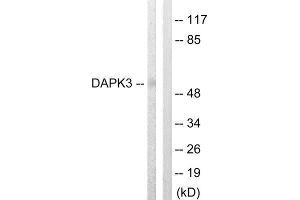 Western Blotting (WB) image for anti-Death-Associated Protein Kinase 3 (DAPK3) (Thr265) antibody (ABIN1848018) (DAPK3 Antikörper  (Thr265))