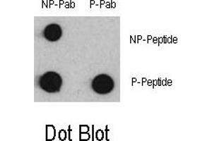 Image no. 1 for anti-Myocyte Enhancer Factor 2C (MEF2C) (pSer387) antibody (ABIN358336) (MEF2C Antikörper  (pSer387))