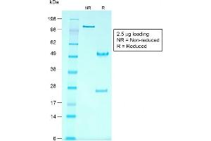 SDS-PAGE Analysis Purified Glypican-3 Mouse Recombinant Monoclonal Ab (rGPC3/863). (Rekombinanter Glypican 3 Antikörper)