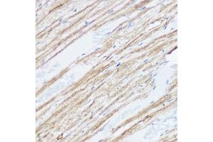 Immunohistochemistry of paraffin-embedded mouse heart using MGLL Rabbit pAb (ABIN6128306, ABIN6143823, ABIN6143824 and ABIN6222352) at dilution of 1:50 (40x lens). (MGLL Antikörper  (AA 1-303))