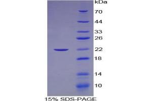 SDS-PAGE analysis of Human Laminin gamma 2 Protein. (LAMC2 Protein)