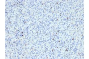 Formalin-fixed, paraffin-embedded human Spleen stained with Perforin Mouse Monoclonal Antibody (SPM434). (Perforin 1 Antikörper  (AA 413-552))