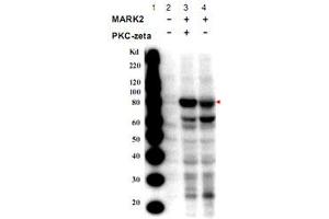 Western blot using MARK2 (phospho T595) polyclonal antibody  shows detection of a band at ~82 kDa corresponding to phosphorylated MARK2 (arrowhead). (MARK2 Antikörper  (pThr595))