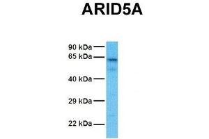 Host:  Rabbit  Target Name:  ARID5A  Sample Tissue:  Human NCI-H226  Antibody Dilution:  1. (ARID5A Antikörper  (N-Term))