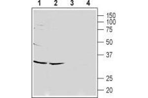 Western blot analysis of rat (lanes 1 and 3) and mouse (lanes 2 and 4) brain lysates: - 1,2. (CACNG7 Antikörper  (1st Extracellular Loop))