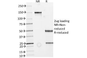 SDS-PAGE Analysis Purified IgA Secretory Component Mouse Monoclonal Antibody (ECM1/792). (Rekombinanter ECM1 Antikörper)