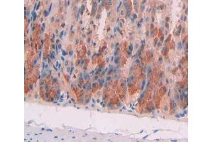 Used in DAB staining on fromalin fixed paraffin- embedded stomach tissue (MCCC1 Antikörper  (AA 484-717))