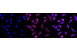anti-Interferon Regulatory Factor 1 (IRF1) antibody
