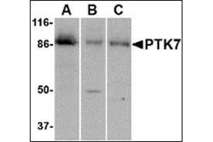 Western blot analysis of PTK7 in (A) human colon, (B) mouse kidney and (C) rat liver tissue lysate with this product at 1 μg/ml.