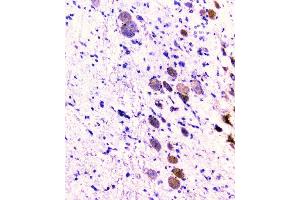 IHC analysis of CD2AP using anti-CD2AP antibody (ABIN6719544). (CD2AP Antikörper  (AA 253-337))