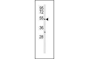 BPI Antikörper  (AA 293-324)