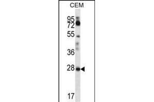 RARRES1 Antibody (C-term) (ABIN657062 and ABIN2846226) western blot analysis in CEM cell line lysates (35 μg/lane). (RARRES1 Antikörper  (C-Term))