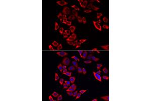 Immunofluorescence analysis of MCF-7 cells using RPL9 antibody (ABIN6291201). (RPL9 Antikörper)