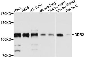 Western blot analysis of extracts of various cell lines, using DDR2 antibody (ABIN4903459) at 1:1000 dilution. (DDR2 Antikörper)