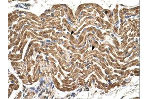 Immunohistochemistry (IHC) image for anti-ATP Synthase, H+ Transporting, Mitochondrial F1 Complex, beta Polypeptide (ATP5B) (N-Term) antibody (ABIN2783268) (ATP5B Antikörper  (N-Term))