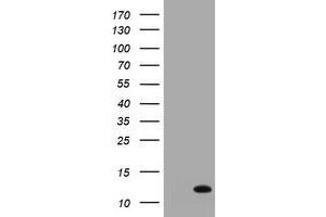 Image no. 1 for anti-S100 Calcium Binding Protein A6 (S100A6) antibody (ABIN1500784) (S100A6 Antikörper)
