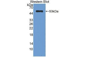 Western blot analysis of the recombinant protein. (CELA1 Antikörper  (AA 40-258))