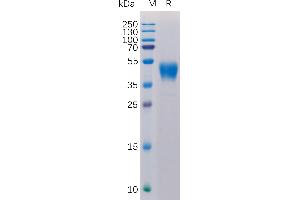 Human CD24 Protein, hFc Tag on SDS-PAGE under reducing condition.