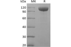 Western Blotting (WB) image for Angiogenin, Ribonuclease A Family, Member 2 (ANG2) protein (Fc Tag) (ABIN7321041) (ANG2 Protein (Fc Tag))