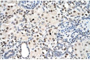 Rabbit Anti-PSME3 Antibody  Paraffin Embedded Tissue: Human Kidney Cellular Data: Epithelial cells of renal tubule Antibody Concentration: 4. (PSME3 Antikörper  (N-Term))